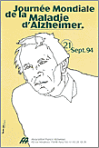 Alzheimer
